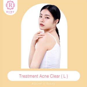 Treatment Acne Size L