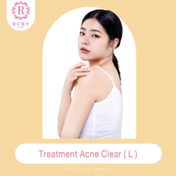 Treatment Acne Size L